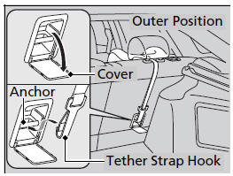 ■ Using an outer anchor